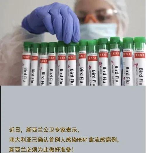 多个国际组织:H5N1型病毒构成的全球公共卫生风险较低