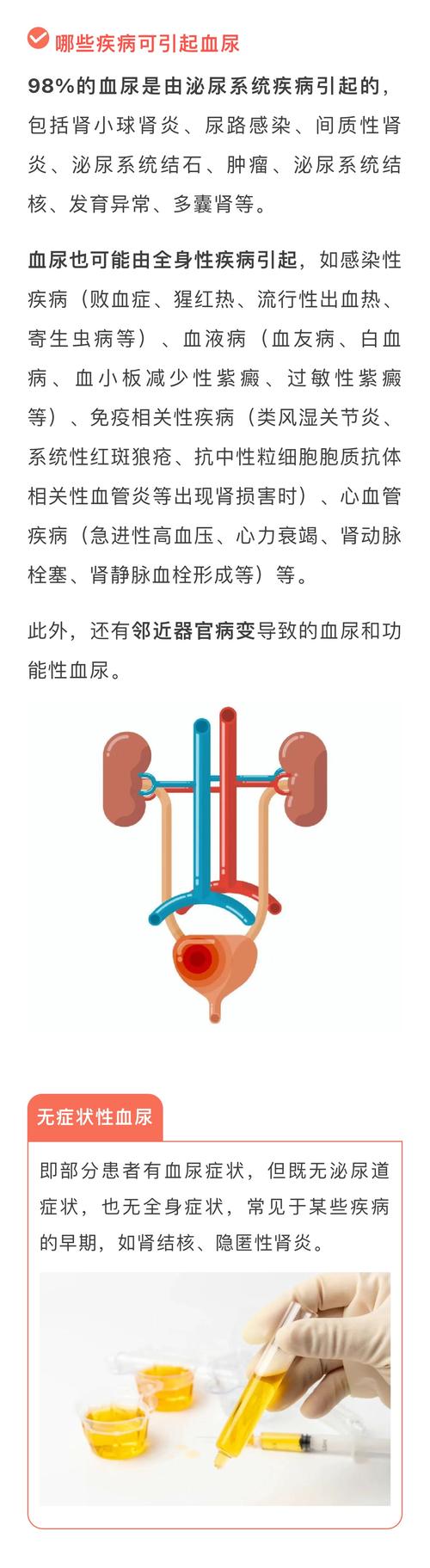 尿路感染、血尿、蛋白尿,应该如何识别这些尿液异常?