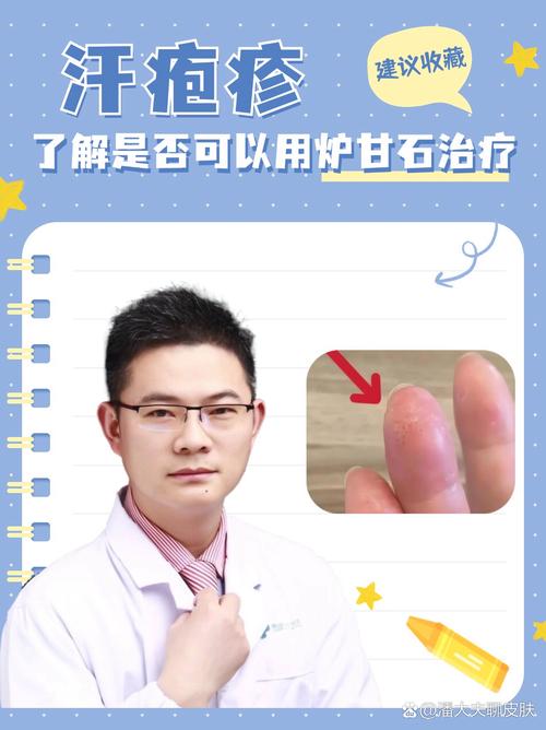 汗疱疹反复发作难恢复?一个外洗方,止痒助消退