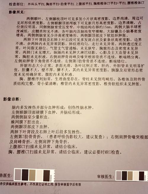 奥孔古因左膝炎症至少缺席四场比赛 一周后重新评估