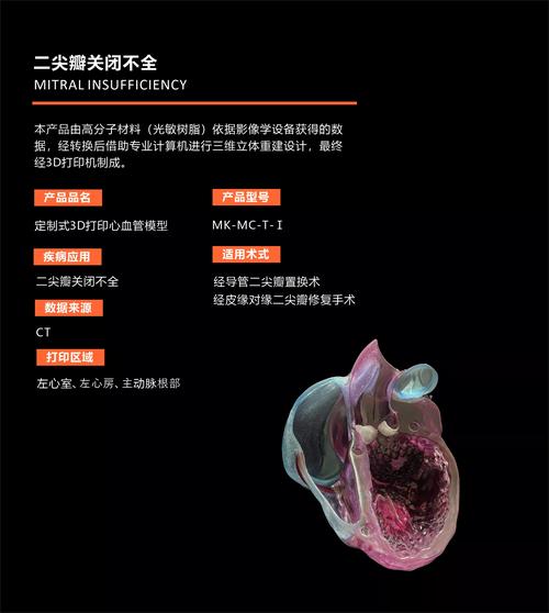 科普|经导管二尖瓣修复术(TEER):现代微创心脏病治疗技术的革命